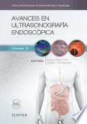 Avances en ultrasonografía endoscópica